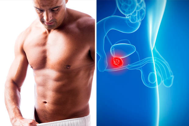 prostate cancer treatment sexual side effects